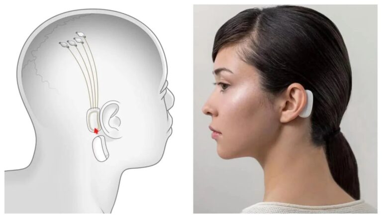 Neuralink – Elon Musk obiecuje, że w piątek pokaże działające urządzenie
