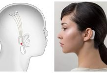 Neuralink – Elon Musk obiecuje, że w piątek pokaże działające urządzenie Neuralink