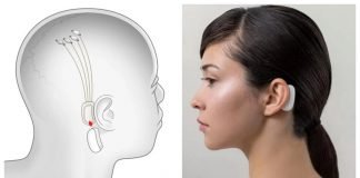 Neuralink – Elon Musk obiecuje, że w piątek pokaże działające urządzenie Neuralink