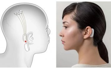 Neuralink – Elon Musk obiecuje, że w piątek pokaże działające urządzenie Neuralink